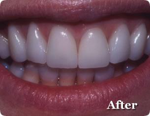 Cosmetic after