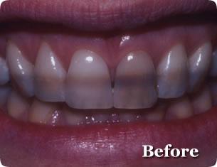 Cosmetic Before